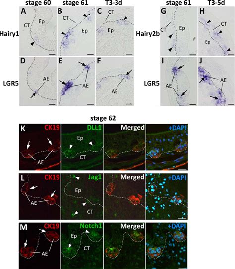 Correlation Of The Expression Patterns Of Notch Pathway Components With