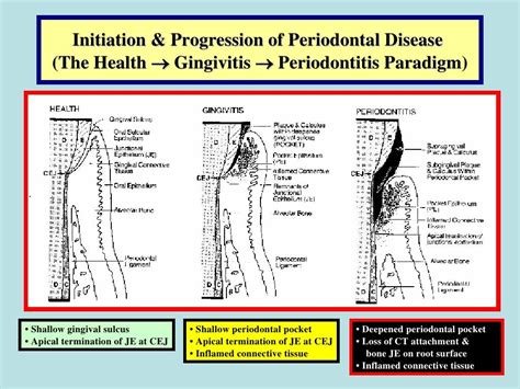 Effect Of Periodontal Infections On Fetal Development And Pregnancy Out