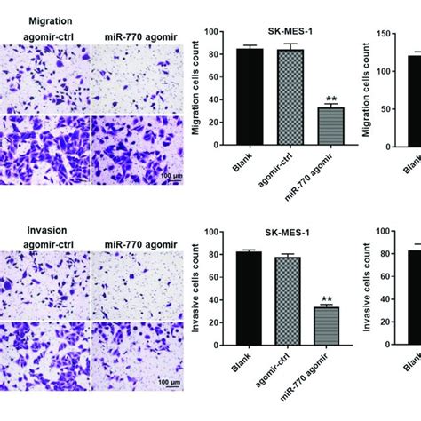 Mir Agomir Inhibited The Migration And Invasion Of Nsclc Cells