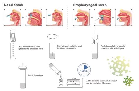 Test Combinado Synthgene SARS CoV 2 Flu A Flu B RSV