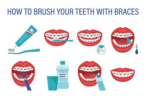 Infografía Sobre Cómo Cepillarse Los Dientes Con Frenillos Instrucciones Paso A Paso Para El