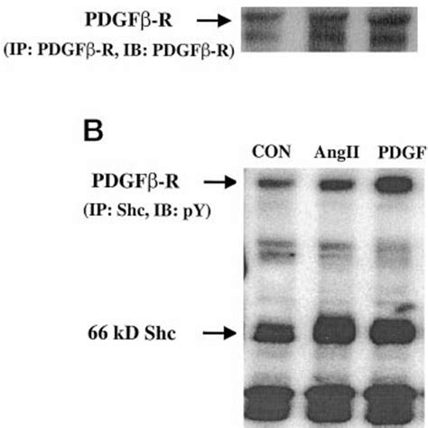 Angii Stimulates Tyrosine Phosphorylation Of The Pdgf R Serum Starved