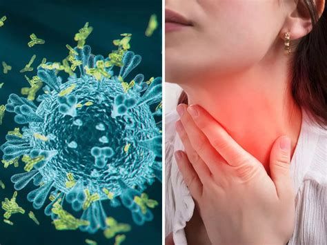 Coronavirus Key Characteristics Of A COVID Sore Throat And Other Top