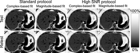 Examples Of Proton Density Fat Fraction Pdff Maps Of Standard And