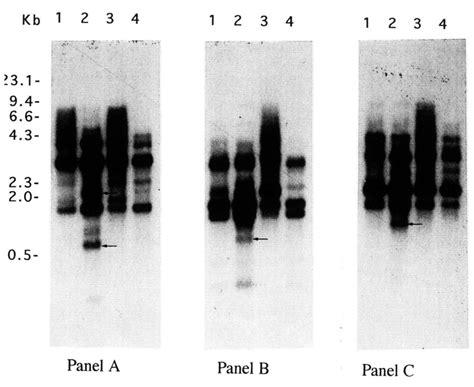 Southern Blot Hybridisation Patterns Of M Incognita Races With