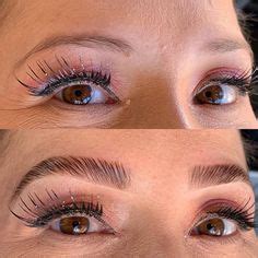 33 Eyebrow Transplant In Turkey Ideas Eyebrow Transplant Eyebrows