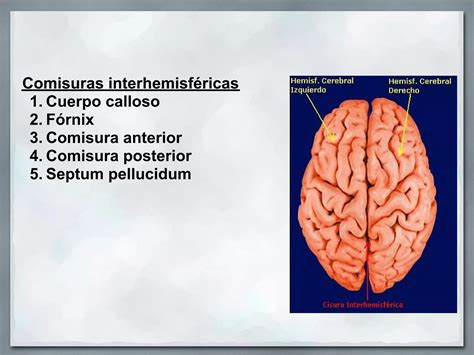 Hemisferios Cerebrales Ppt