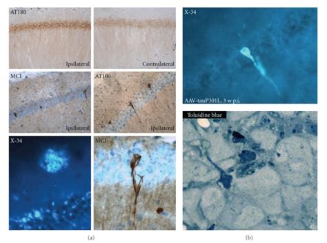 Protein Tau Is Activated By And Therefore Downstream Of Amyloid Download Scientific Diagram