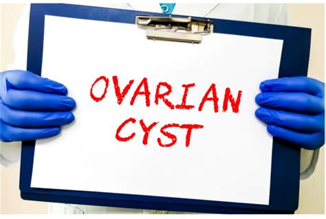 Your Guide To Safe And Effective Ovarian Cyst Surgery In Mumbai