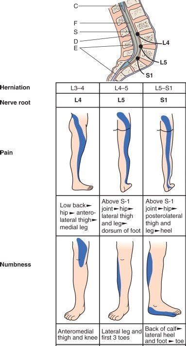 Where is your leg pain? — Knotry