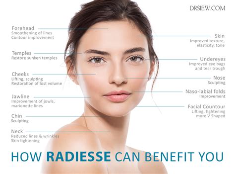 Radiesse The Most Versatile Filler For Lifting And Rejuvenation Dr Siew