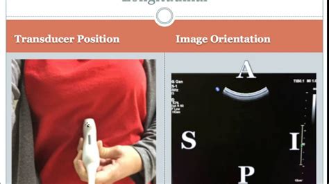 Image Orientation And Transducer Position Youtube