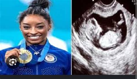 Just In Fox News Just Reported That Gold Medalist Simone Biles Is Pregnant At The 2024 Olympics