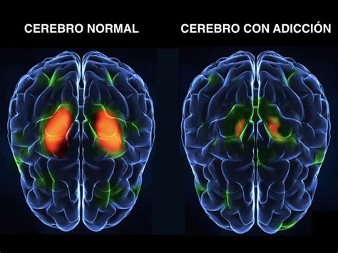 10 Efectos Del Alcohol Sobre El Sistema Nervioso Y El Cerebro Luis