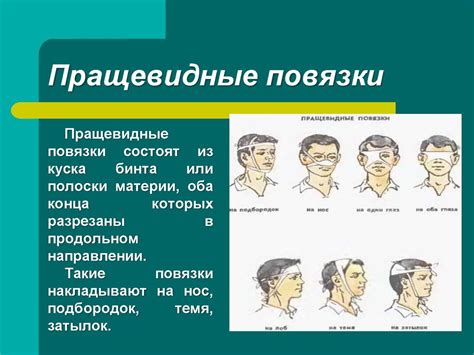 Техника наложения повязок и иммобилизация - презентация онлайн