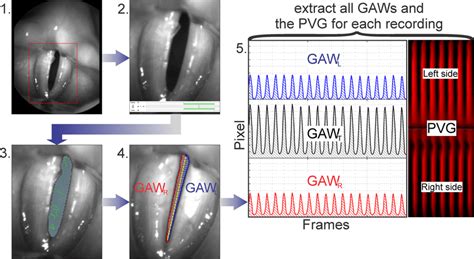 Segmentation Process 1 Selection Of The Glottis Region 2 Selection