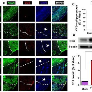 Combined Curcumin Huc Msc Treatment Promoted Anti Inflammatory