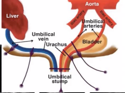 Abnormalities Of Urogenital Tract Flashcards Quizlet