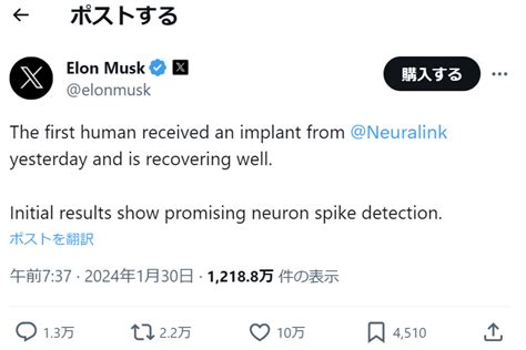 B ガジェット イーロン・マスクのneuralink、脳神経直結チップのヒトへの移植に成功