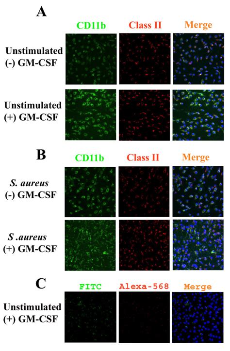 Microglial Cd B But Not Mhc Class Ii Expression Is Influenced By Low