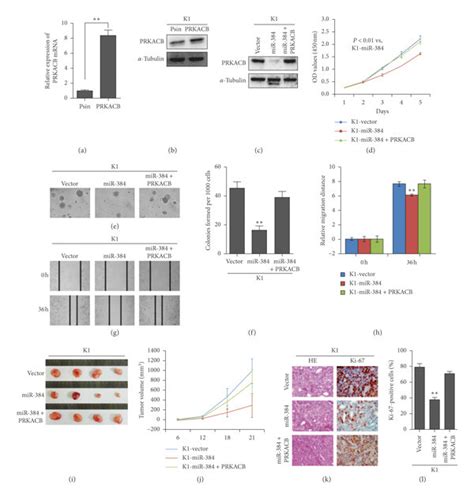 Mir Inhibited The Progression Of Ptc Cells By Targeting Prkacb