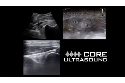 Soft Tissue - Core Ultrasound