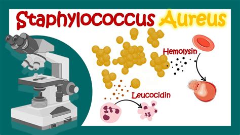 Staphylococcus Aureus Pathology Microbiology What Is The Best