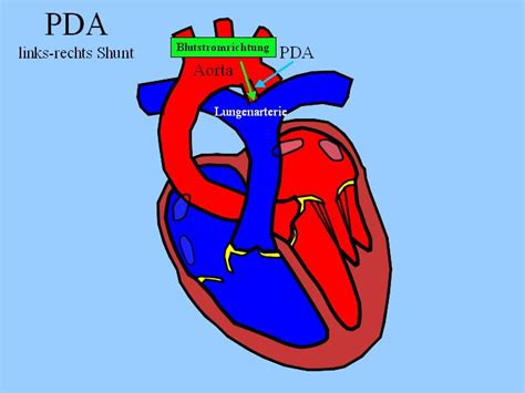 Persistierender Ductus Arteriosus Botalli Pda Tierarztpraxis Dr