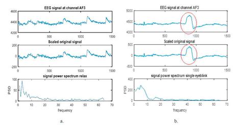 Eeg Signal And Power Spectrum A Relaxed State B Cognitive Activity