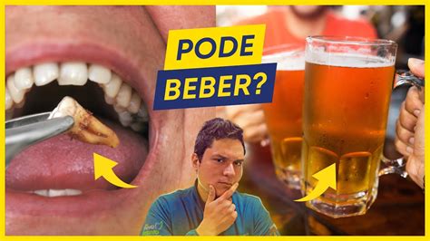 Quem Arranca Dente Pode Beber Cerveja - PODE BEBER CERVEJA APÓS EXTRAIR DENTE? - YouTube