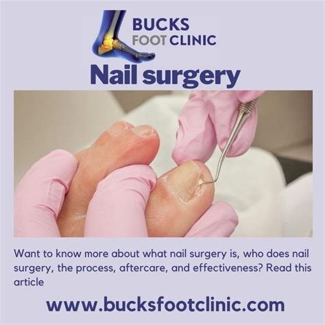 Pin On Ingrown Toenails