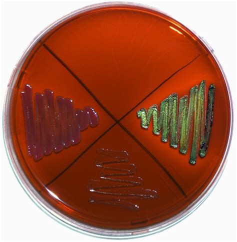 Lab Ex Eosin Methylene Blue Emb Agar Flashcards Quizlet