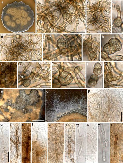 Morphological Characters Of Pleostigma Frigidum And P Lichenophilum