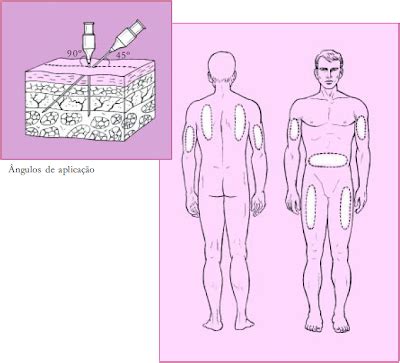 Enfermagem Para Auxiliares Administrando Medicamentos Por Via Parenteral