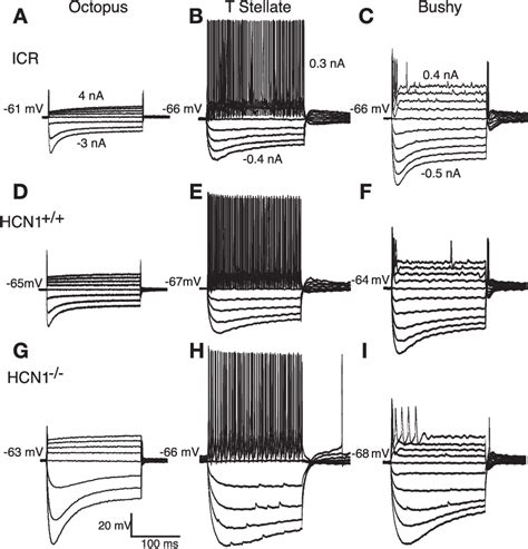 Figure From The Magnitudes Of Hyperpolarization Activated And Low