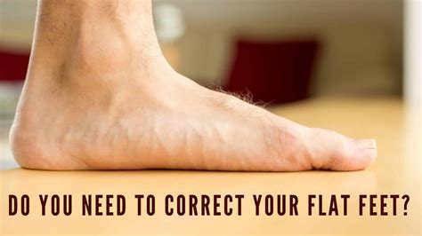 Flat Feet Treatment Well Heeled Podiatry Hampton Melbourne