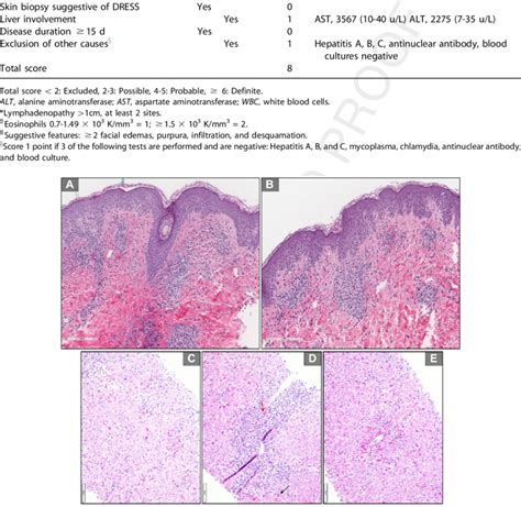 A 200 Um Scanning Magnification Of Hematoxylin And Eosin Skin Biopsy