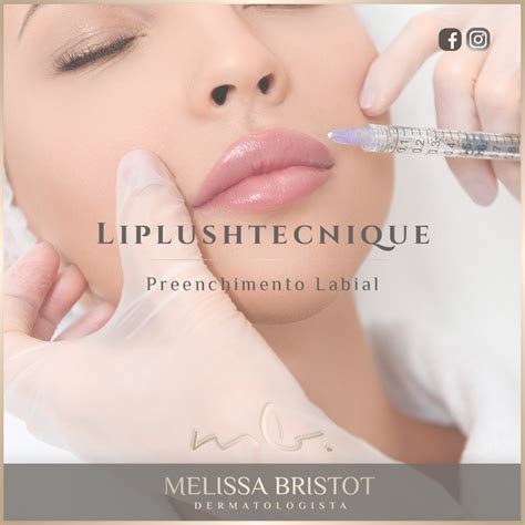 Dra Melissa Bristot Dermatologista Preenchimento Labial