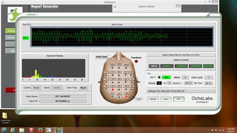 LENS (Low Energy Neurofeedback System) | Neurofeedback & Integrated ...