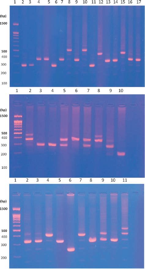 Figure 1 From Heteroplasmy And Length Variation In The TRNApro Dloop