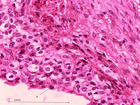 Transitional Epithelium 40x Histology