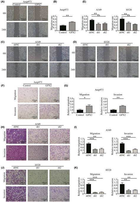 GPX2 Promotes Migration And Invasion Of NSCLC Cells A B GPX2stable