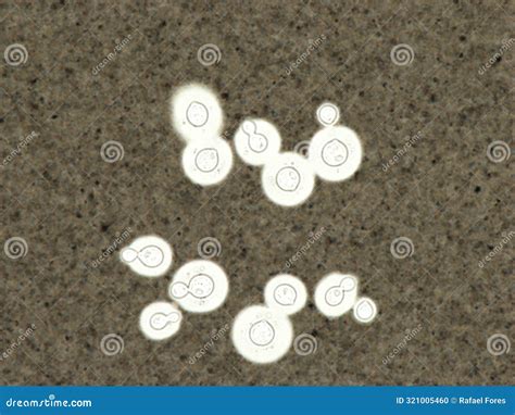 Cryptococcus In Peripheral Blood Smear India Ink Stock Photo Image