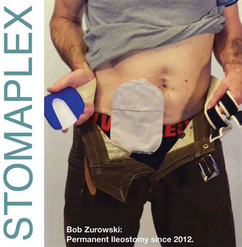 Colostomy Stoma Bag