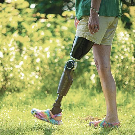 What Are The Parts of a Prosthetic Leg? | Össur Prosthetics