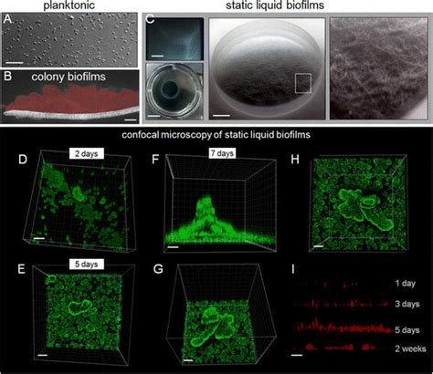 Growth And Development Of Haloferax Volcanii Static Liquid Biofilms