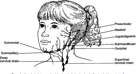 Figure 1 From Cute Subacute And Chronic Cervical Lymphadenitis In