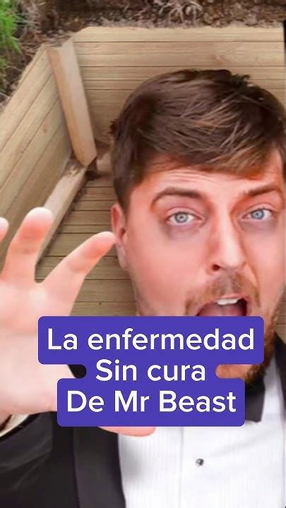 La Verdad Detrás De La Enfermedad Sin Cura De Mrbeast Sabiasque