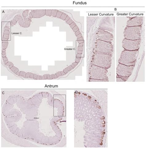 Spasmolytic Polypeptide Expressing Metaplasia Spem In The Gastric