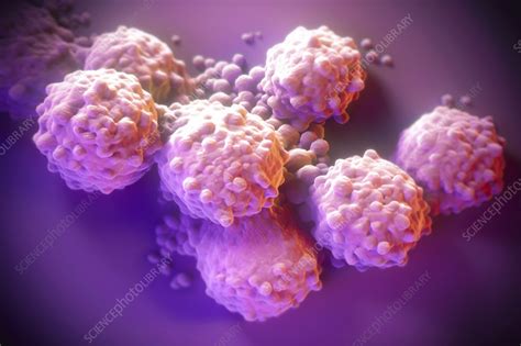 Cancer Cells Illustration Stock Image C057 7771 Science Photo